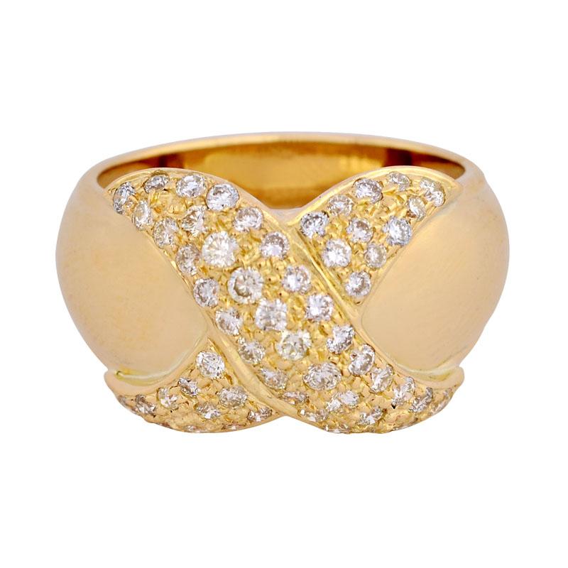 Ring-Diamond